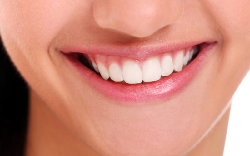 best smile makeover dentist in Hadapsar
