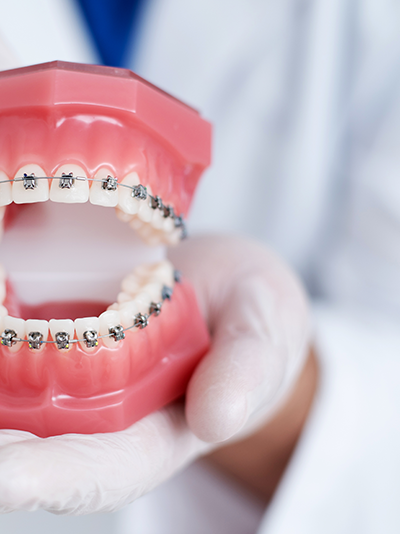 orthodontic braces treatment in Hadapsar