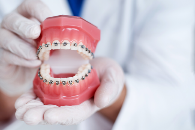 orthodontic-braces-treatment-in-Hadapsar orthodontic braces treatment in Hadapsar